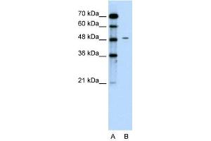 Chromogranin A antibody used at 0. (Chromogranin A Antikörper)