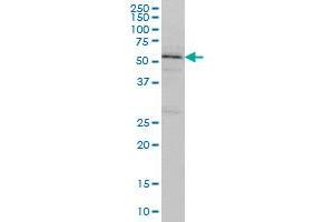 TOM1 monoclonal antibody (M01), clone 5A3 Western Blot analysis of TOM1 expression in K-562 . (TOM1 Antikörper  (AA 394-491))