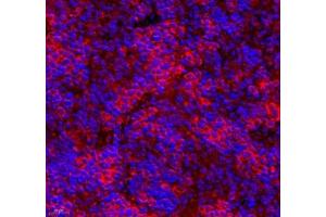 Immunofluorescence of paraffin embedded mouse spleen using CNG1 (ABIN7073608) at dilution of 1:700 (400x lens) (CNGA1 Antikörper)