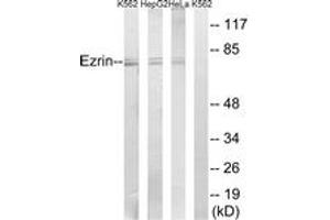 Western blot analysis of extracts from HeLa/HepG2/K562 cells, using Ezrin (Ab-146) Antibody. (Ezrin Antikörper  (AA 111-160))