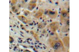 Used in DAB staining on fromalin fixed paraffin-embedded Liver tissue (IFNA2 Antikörper  (AA 24-188))