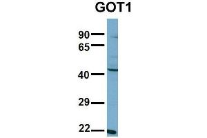 Host:  Rabbit  Target Name:  GOT1  Sample Type:  NCI-H226  Antibody Dilution:  1. (GOT1 Antikörper  (N-Term))