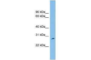 WB Suggested Anti-FAM109A Antibody Titration: 0. (FAM109A Antikörper  (N-Term))