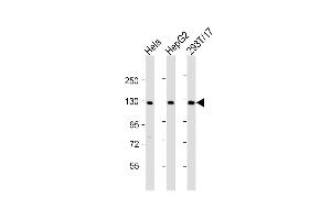 Western Blot at 1:2000 dilution Lane 1: Hela whole cell lysate Lane 2: HepG2 whole cell lysate Lane 3: 293T/17 whole cell lysate Lysates/proteins at 20 ug per lane. (LRIG3 Antikörper  (AA 23-54))