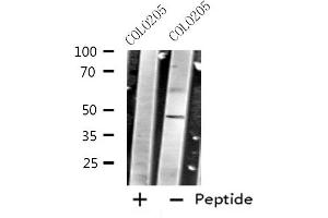 Western blot analysis of extracts from COLO205 cells using CRHR2 antibody. (CRHR2 Antikörper  (Internal Region))