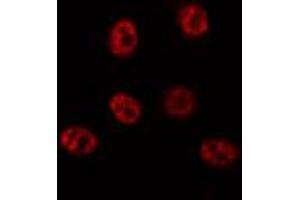 ABIN6272425 staining 293 by IF/ICC. (SCAF1 Antikörper  (N-Term))