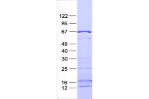 Western Blotting (WB) image for serum/glucocorticoid Regulated Kinase Family, Member 3 (SGK3) protein (His tag) (ABIN2731935)