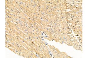 Phospho-IL4R/CD124 (Tyr497) Antibody at 1/100 staining Rat heart tissue by IHC-P. (IL4 Receptor Antikörper  (pTyr497))