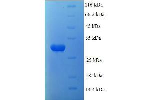 SDS-PAGE (SDS) image for phosphoserine Aminotransferase 1 (PSAT1) (AA 1-251), (partial) protein (His tag) (ABIN5710169) (PSAT1 Protein (AA 1-251, partial) (His tag))