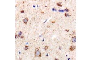 Immunohistochemical analysis of CHMP1B staining in rat brain formalin fixed paraffin embedded tissue section. (CHMP1B Antikörper)
