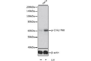 Western blot analysis of extracts of HeLa cells, using Phospho-Chk2-T68 antibody (ABIN6135202, ABIN6136046, ABIN6136047 and ABIN6225610). (CHEK2 Antikörper  (pThr68))