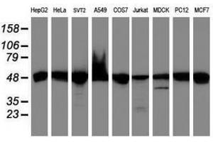 Image no. 2 for anti-Ubiquinol-Cytochrome C Reductase Core Protein I (UQCRC1) (AA 46-305) antibody (ABIN1491532)