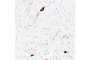 Immunohistochemistry of paraffin-embedded rat brain using Somatostatin (SST) Rabbit mAb (ABIN7270492) at dilution of 1:1000 (40x lens). (Somatostatin Antikörper  (AA 23-116))