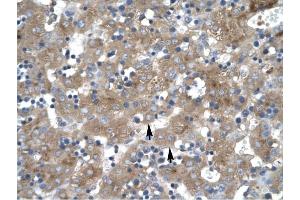 ZNF81 antibody was used for immunohistochemistry at a concentration of 4-8 ug/ml to stain Hepatocyte (arrows) in Human liver.