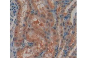 IHC-P analysis of Rat Tissue, with DAB staining. (Androgen Receptor Antikörper  (AA 491-679))