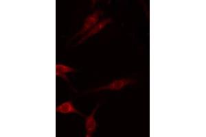ABIN6275280 staining Hela by IF/ICC. (MT-ND1 Antikörper  (Internal Region))