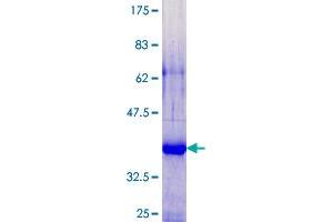 SPRR2G Protein (AA 1-73) (GST tag)