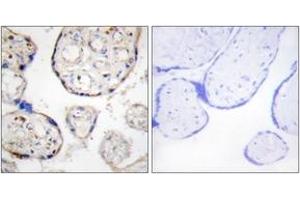 Immunohistochemistry analysis of paraffin-embedded human placenta tissue, using STEAP4 Antibody. (STEAP4 Antikörper  (AA 201-250))