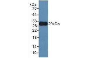 Detection of Recombinant MMP25, Human using Monoclonal Antibody to Matrix Metalloproteinase 25 (MMP25) (MMP25 Antikörper  (AA 108-313))