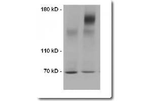 Western Blotting (WB) image for Transmembrane Protein Extraction Reagent (ABIN1059100) (Transmembrane Protein Extraction Reagent)