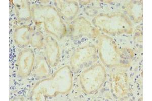 Immunohistochemistry of paraffin-embedded human kidney tissue using ABIN7158756 at dilution of 1:100 (LYPLAL1 Antikörper  (AA 2-237))