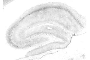 Adult rat hippocampus immunohistochemistry.