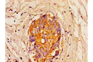 Immunohistochemistry (IHC) image for anti-Inositol 1,4,5-Trisphosphate Receptor, Type 1 (ITPR1) (AA 1707-1966) antibody (ABIN7156293)