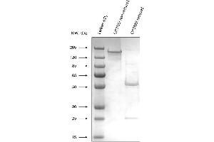 Expression of recombinant CR3022 antibody (SARS-CoV-2 Antikörper)