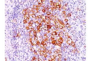 Immunohistochemistry (IHC) image for anti-Tumor Necrosis Factor Receptor Superfamily, Member 8 (TNFRSF8) antibody (ABIN6941146)