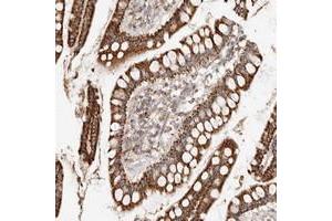 Immunohistochemical staining of human small intestine with ARHGEF10L polyclonal antibody  strong cytoplasmic positivity in glandular cells.