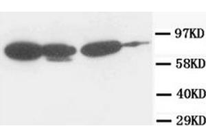 Western Blotting (WB) image for anti-Junction Plakoglobin (JUP) antibody (ABIN1107897) (JUP Antikörper)