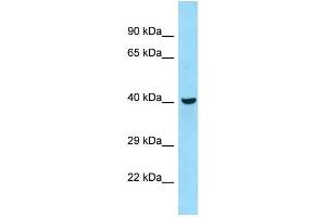 WB Suggested Anti-Qtrtd1 Antibody Titration: 1. (QTRTD1 Antikörper  (C-Term))