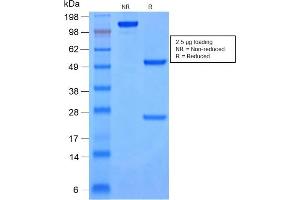 SDS-PAGE Analysis Purified Cytokeratin 8/18 Mouse Monoclonal Antibody (rKRT8. (Rekombinanter KRT8, KRT18 Antikörper)