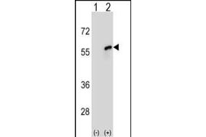 Western blot analysis of CDC20 (arrow) using rabbit polyclonal CDC20 Antibody (N-term) (ABIN653082 and ABIN2842679). (CDC20 Antikörper  (N-Term))