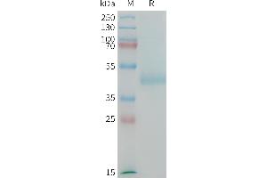 SDS-PAGE (SDS) image for LI Cadherin (AA 567-667) protein (Fc Tag) (ABIN7538359)
