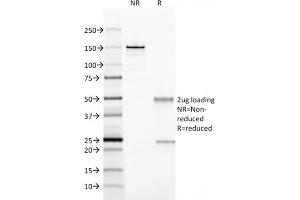 SDS-PAGE Analysis Purified CD28 Mouse Monoclonal Antibody (204. (CD28 Antikörper)