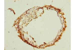 Immunohistochemistry of paraffin-embedded human testis tissue using ABIN7144623 at dilution of 1:100 (ARMCX2 Antikörper  (AA 161-460))