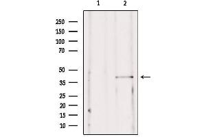 Western blot analysis of extracts from mouse brain, using SSTR2  Antibody. (SSTR2 Antikörper  (C-Term))