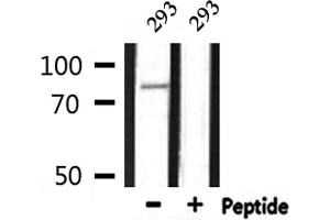 Western blot analysis of extracts from 293, using CDH3 Antibody. (P-Cadherin Antikörper  (N-Term))