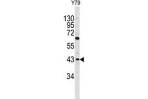 Western blot analysis of PRELP antibody (C-term) in Y79 cell line lysates (35ug/lane). (PRELP Antikörper  (C-Term))