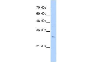 WB Suggested Anti-RHBDL2 Antibody Titration:  0. (RHBDL2 Antikörper  (N-Term))