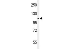 Western Blotting (WB) image for anti-EPH Receptor A2 (EPHA2) (AA 30-60) antibody (ABIN3030817)
