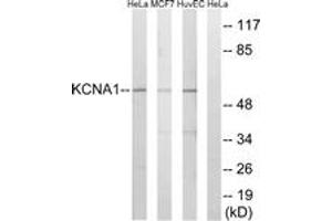 Western blot analysis of extracts from HuvEc/MCF-7/HeLa cells, using KCNA1 Antibody. (KCNA1 Antikörper  (AA 256-305))