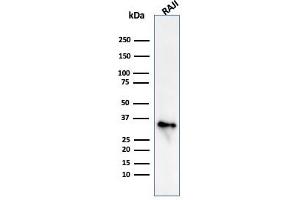 Western Blot Analysis of Raji cell lysate using CD74 Mouse Monoclonal Antibody (CLIP/813) (CD74 Antikörper)