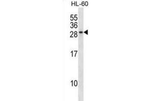 Western Blotting (WB) image for anti-RAB15, Member RAS Onocogene Family (RAB15) antibody (ABIN2998980) (RAB15 Antikörper)