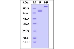 SDS-PAGE (SDS) image for CD4 (CD4) (AA 26-396) (Active) protein (Fc Tag,AVI tag,Biotin) (ABIN5674591)
