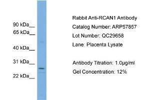 WB Suggested Anti-RCAN1  Antibody Titration: 0. (RCAN1 Antikörper  (N-Term))