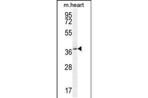 Western blot analysis in mouse heart tissue lysates (35ug/lane). (NAA30 Antikörper  (C-Term))