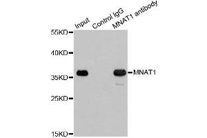 Immunoprecipitation analysis of 200 μg extracts of 293T cells using 1 μg MNAT1 antibody (ABIN5970984). (MNAT1 Antikörper)