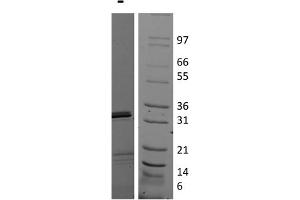 SDS-PAGE of Human Interleukin-17E (IL-25) Recombinant Protein SDS-PAGE of Human Interleukin-17E (IL-25) Recombinant Protein.